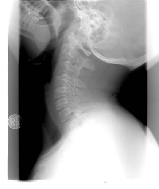 malpractice injuries