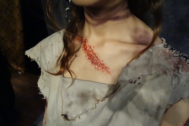 bicycle injury