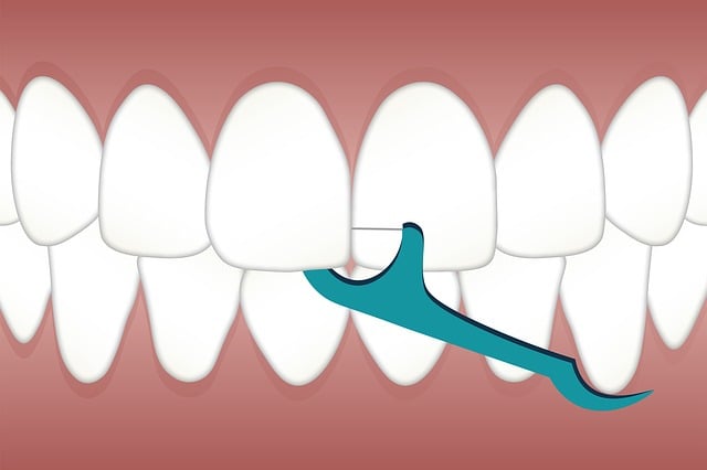 dental cleaning