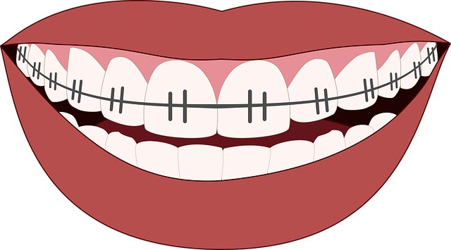 Unlock Your Brightest Smile: Professional Teeth Whitening Guide