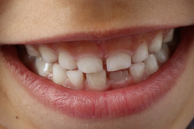 Dental Checkups: Essential Care for Healthy Teeth and Gums