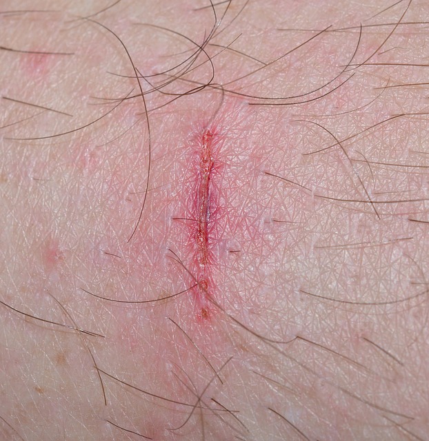 premises injury