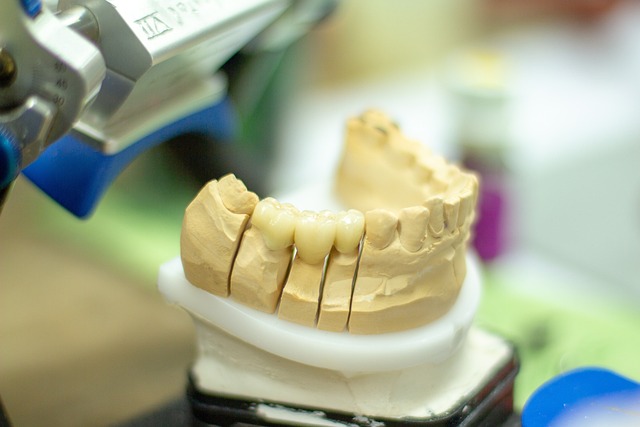 prosthodontics dentistry