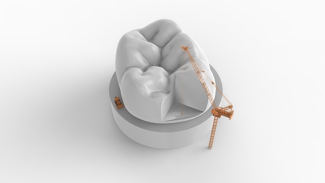 tooth bonding dentistry