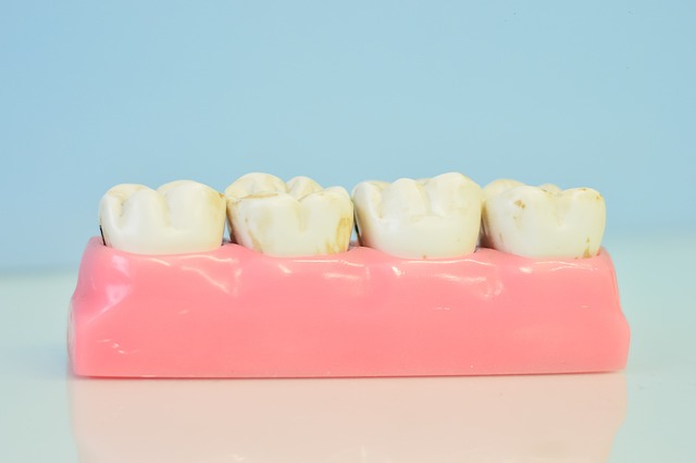 wisdom teeth dentistry