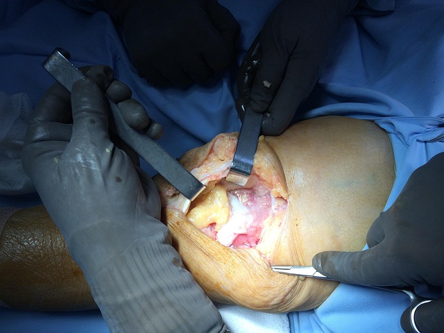 oral surgery