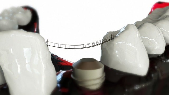 orthodontics dentistry