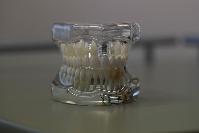 prosthodontics dentistry