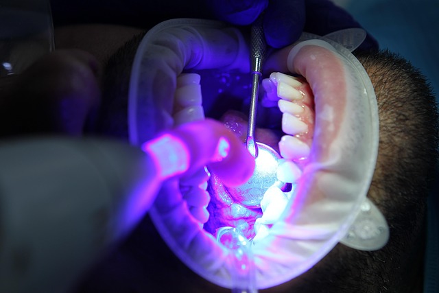 teeth whitening