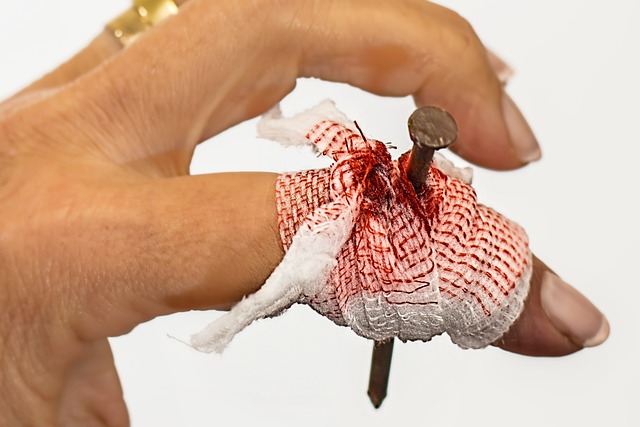 boating accident injuries