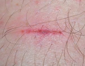 boating-accident-injuries-640x480-93551865.jpeg