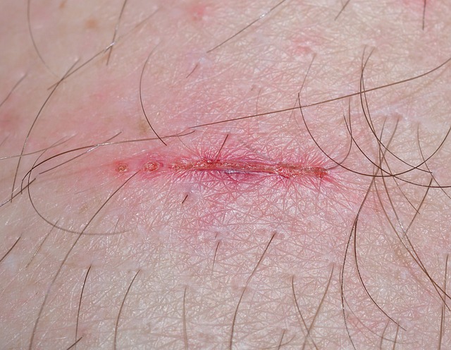 boating injuries