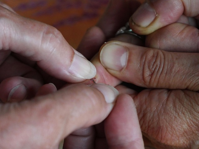 boating-injuries-640x480-96136536.jpeg