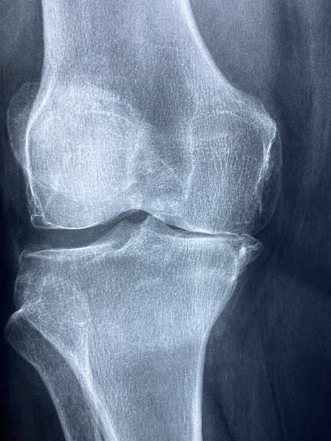 catastrophic injuries