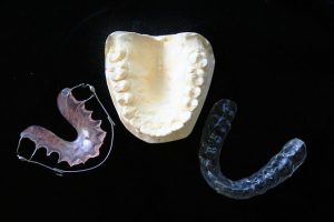dental-checkups-640x480-10598125.jpeg