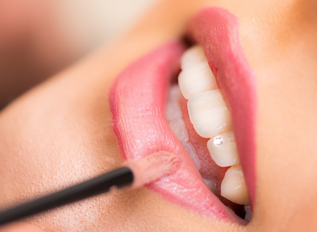 dental checkups