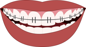 dental-checkups-640x480-77692844.png