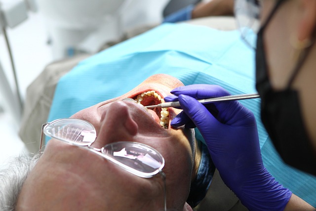 dental implants