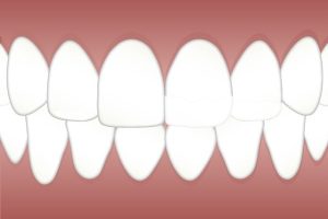 endodontics-dentistry-640x480-28043512.jpeg