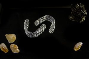 invisalign-640x480-2817618.jpeg