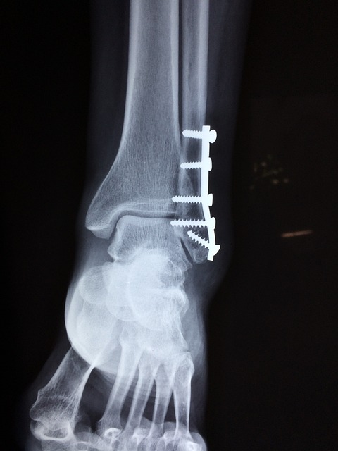 malpractice injuries