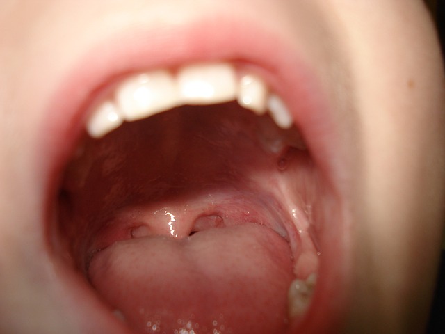 night guards for oral health