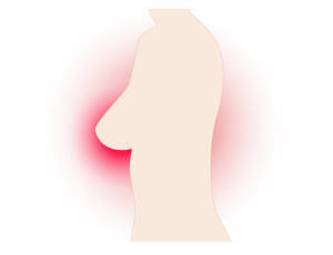oral-cancer-640x480-46585083.png