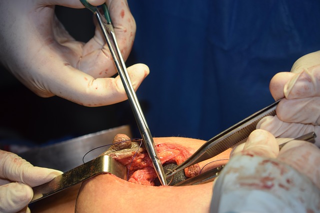 oral surgery