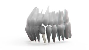 orthodontics-dentistry-640x480-22223834.jpeg