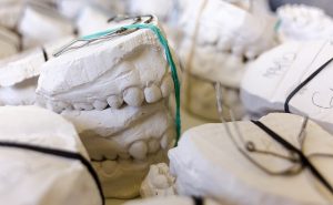 orthodontics-dentistry-640x480-32879750.jpeg
