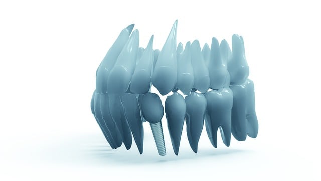 orthodontics dentistry