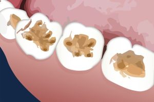 orthodontics-dentistry-640x480-83566305.jpeg