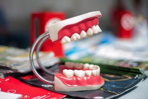 orthodontics-dentistry-640x480-97845893.jpeg