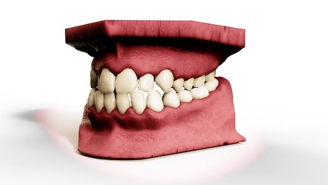 orthodontics dentistry