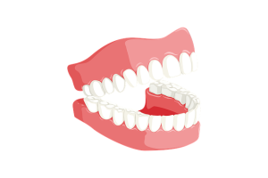 pediatric-dentistry-640x480-59677449.png