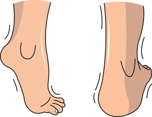 personal-injury-law-640x480-24501215.png