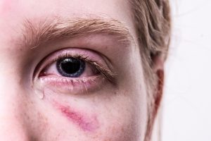 personal-injury-law-640x480-72126013.jpeg