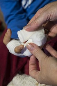 product-liability-claim-injuries-640x480-70378355.jpeg