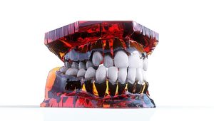 teeth-grinding-solutions-640x480-34455570.jpeg
