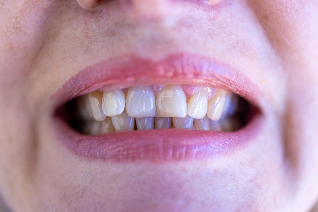 teeth-grinding-solutions-640x480-54870036.jpeg