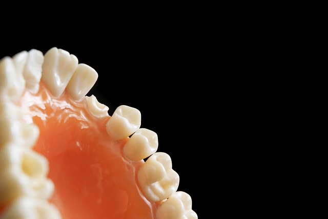 tooth bonding dentistry