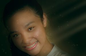 tooth-braces-640x480-60858103.jpeg