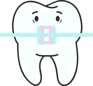 tooth-braces-640x480-85835339.png