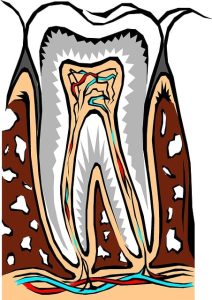 tooth-extractions-640x480-41345131.jpeg