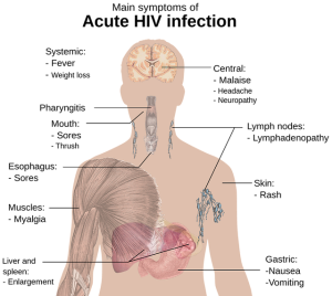 toothache-symptoms-640x480-10775714.png