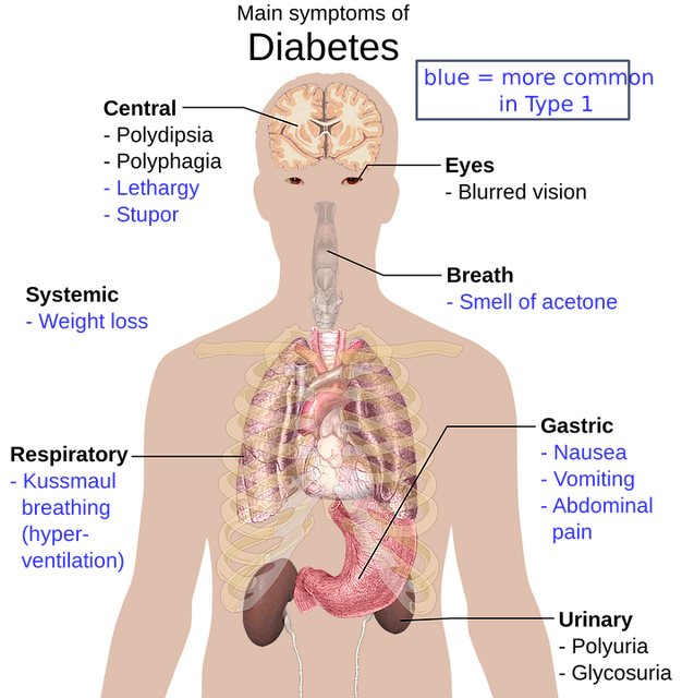 toothache symptoms