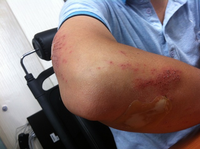 wrongful-death-claim-injuries-640x480-42914063.jpeg