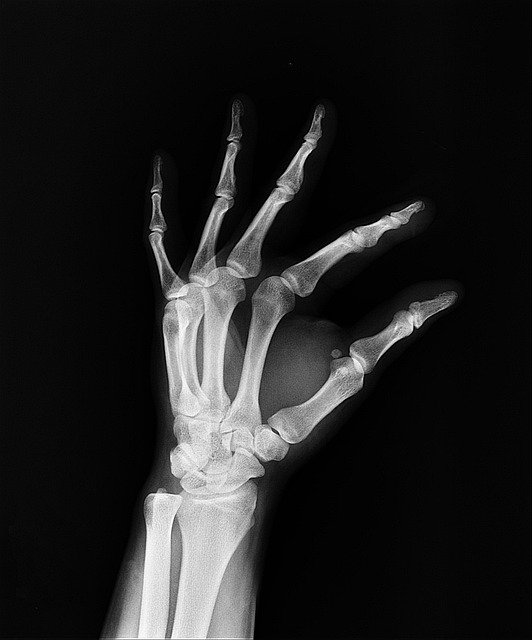 Streamline Medical Malpractice Claims: A Comprehensive Guide for Success