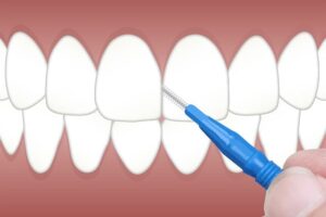 periodontics-dentistry-640x480-99658177.jpeg