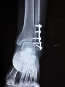 personal-injury-rights-640x480-6104043.jpeg